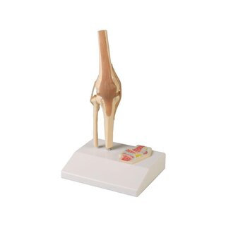 Miniatur-Kniegelenk mit Querschnitt