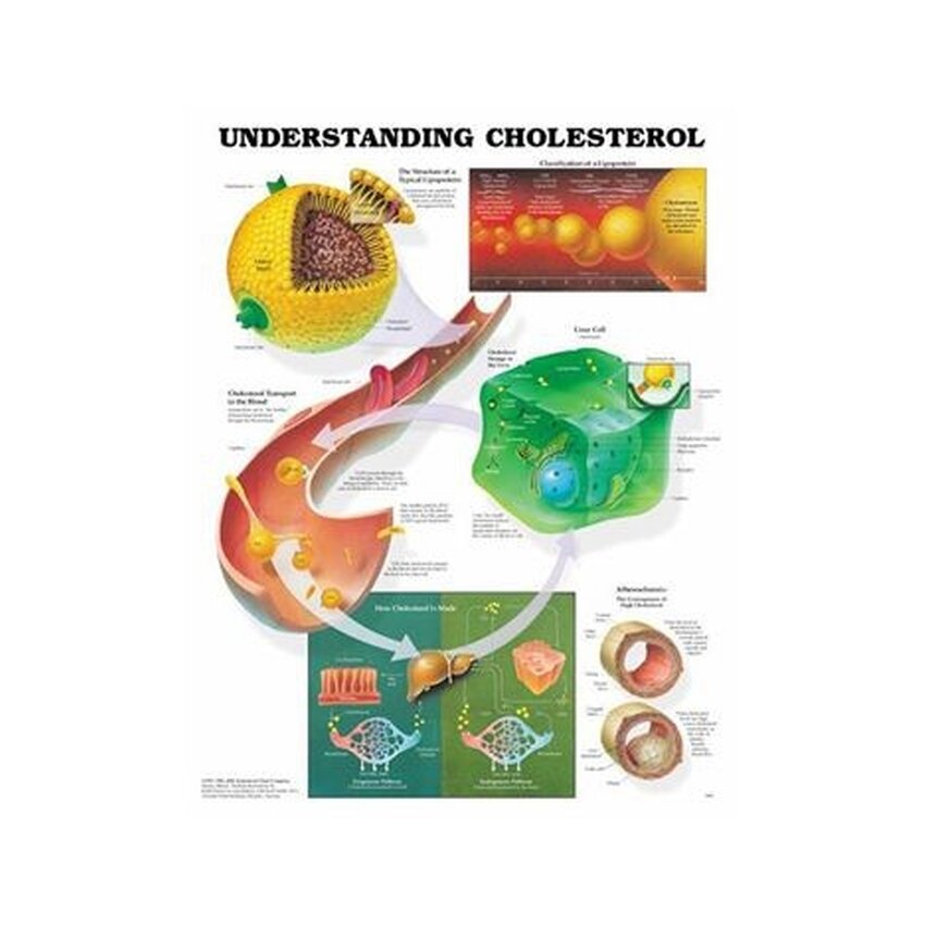 Cholesterin laminierte Poster 51x66 cm verstehen