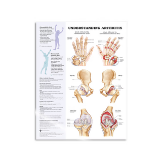 Arthritis laminiert Englisch
