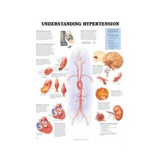 Laminiertes Poster "Bluthochdruck verstehen“ 51x66 cm