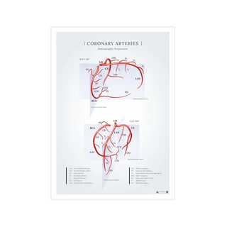 Poster über die Koronararterien des Herzens in Röntgenprojektionen