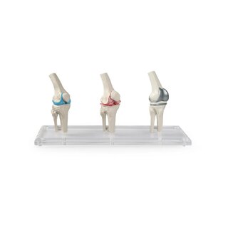 Knieimplantat-Modell