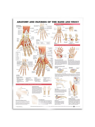 Poster - Anatomie und Pathologie der Hand und Handgelenk