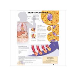 Zu hohes Cholesterin laminiert Poster mit den Ringlöchern